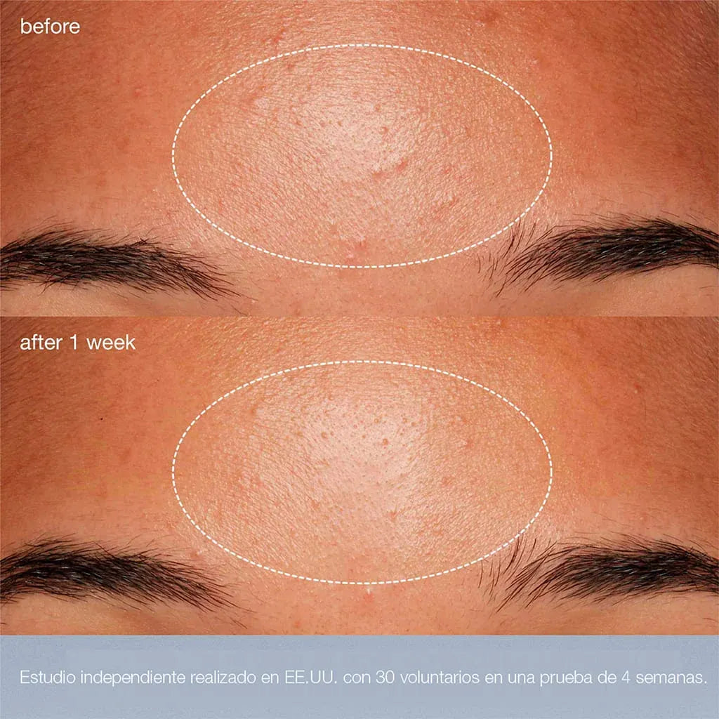 DERMALOGICA - DAILY MICROFOLIANT